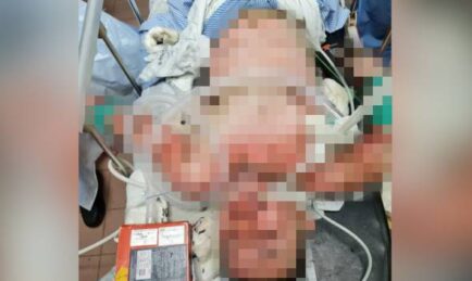 Kereta Dibaiki Masih Rosak. Lelaki Berang Bakar Mekanik